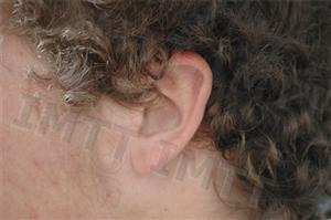 Na condução automóvel há situações em que a audição se pode sobrepor à visão permitindo ao indivíduo evitar a ocorrência de um acidente.